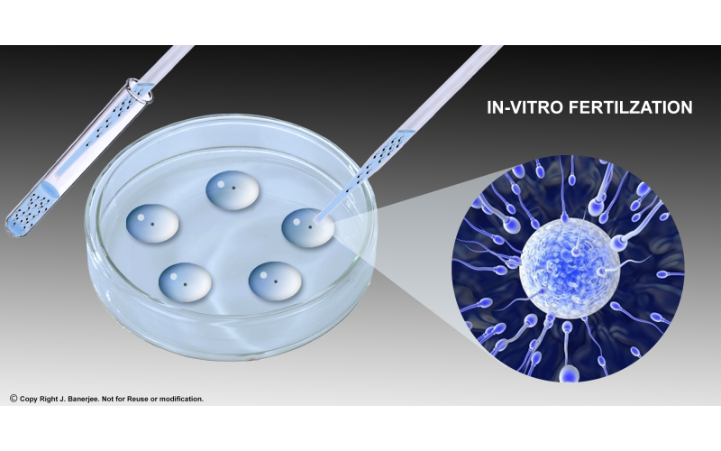 體外受精技術(shù)平臺(tái)